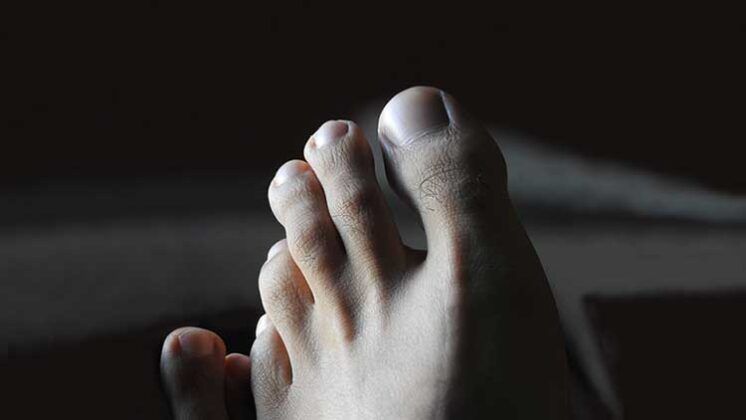 https://volviendoanacer.es | Bioterapias & Hipnosis Integrativa Profesional Madrid y Online | Dedos de los Pies... Conflictos biológicos y Resentir emocional